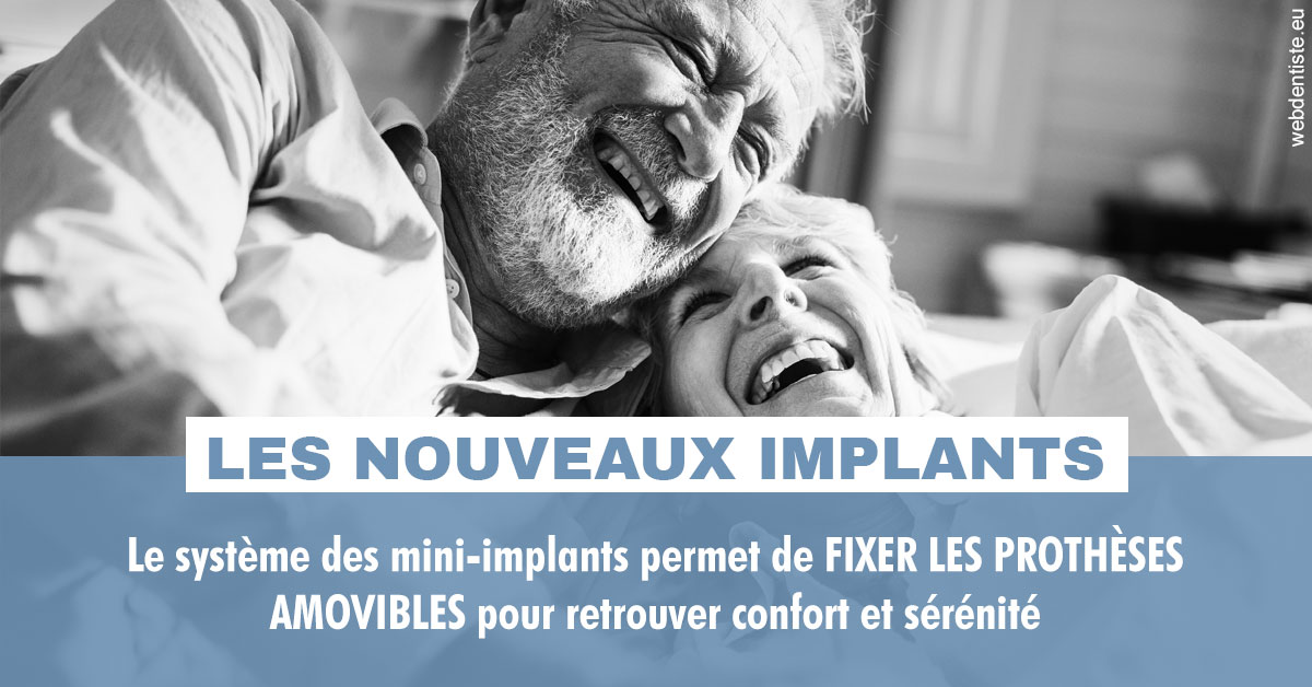 https://www.hygident-oceanis.fr/Les nouveaux implants 2