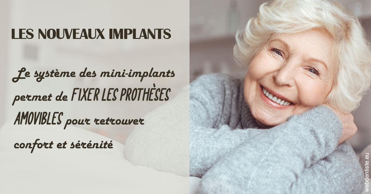 https://www.hygident-oceanis.fr/Les nouveaux implants 1