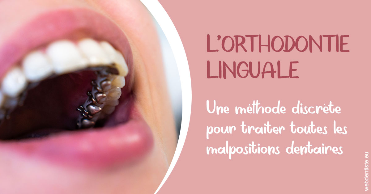 https://www.hygident-oceanis.fr/L'orthodontie linguale 2