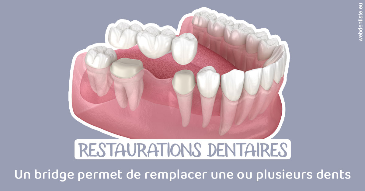 https://www.hygident-oceanis.fr/Bridge remplacer dents 1